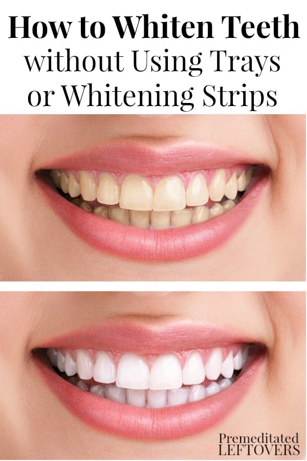 Want to remove stains from your teeth, but don't like peroxide whitening strips or tooth bleaching trays? Here's How to Whiten Your Teeth without Using Whitening Strips or Trays